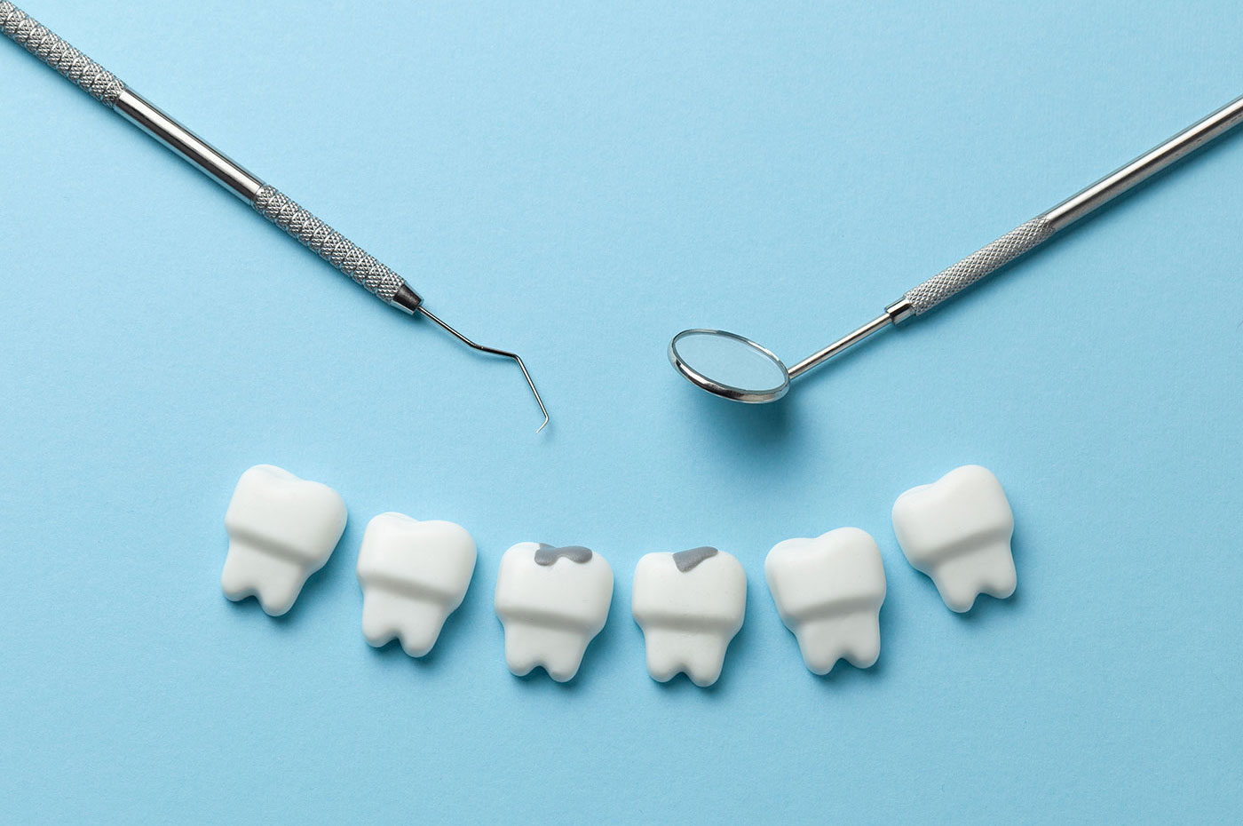 fillings