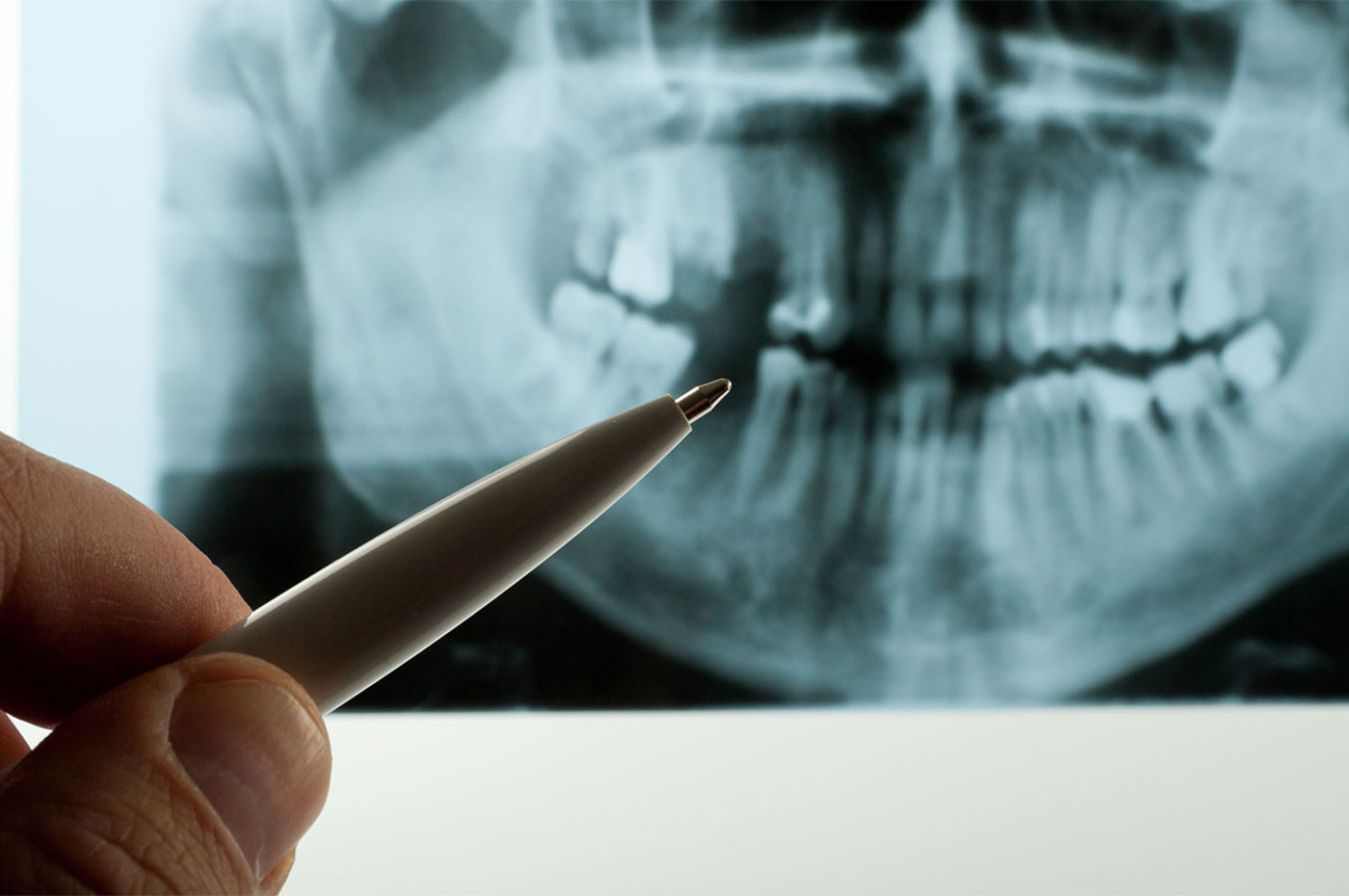 radiographs