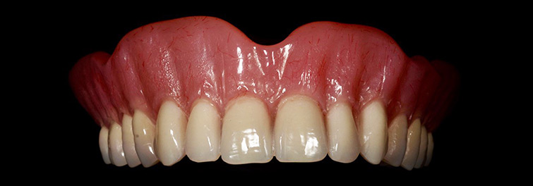 Ilfracombe_Dentures_Advanced