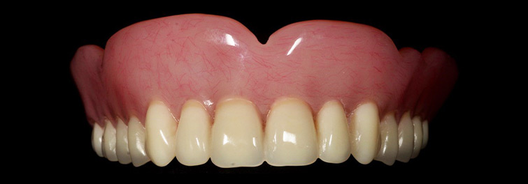 Ilfracombe_Dentures_Standard